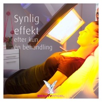 Beauty Angel behandling hos klinik Skinstyle i Ulfborg